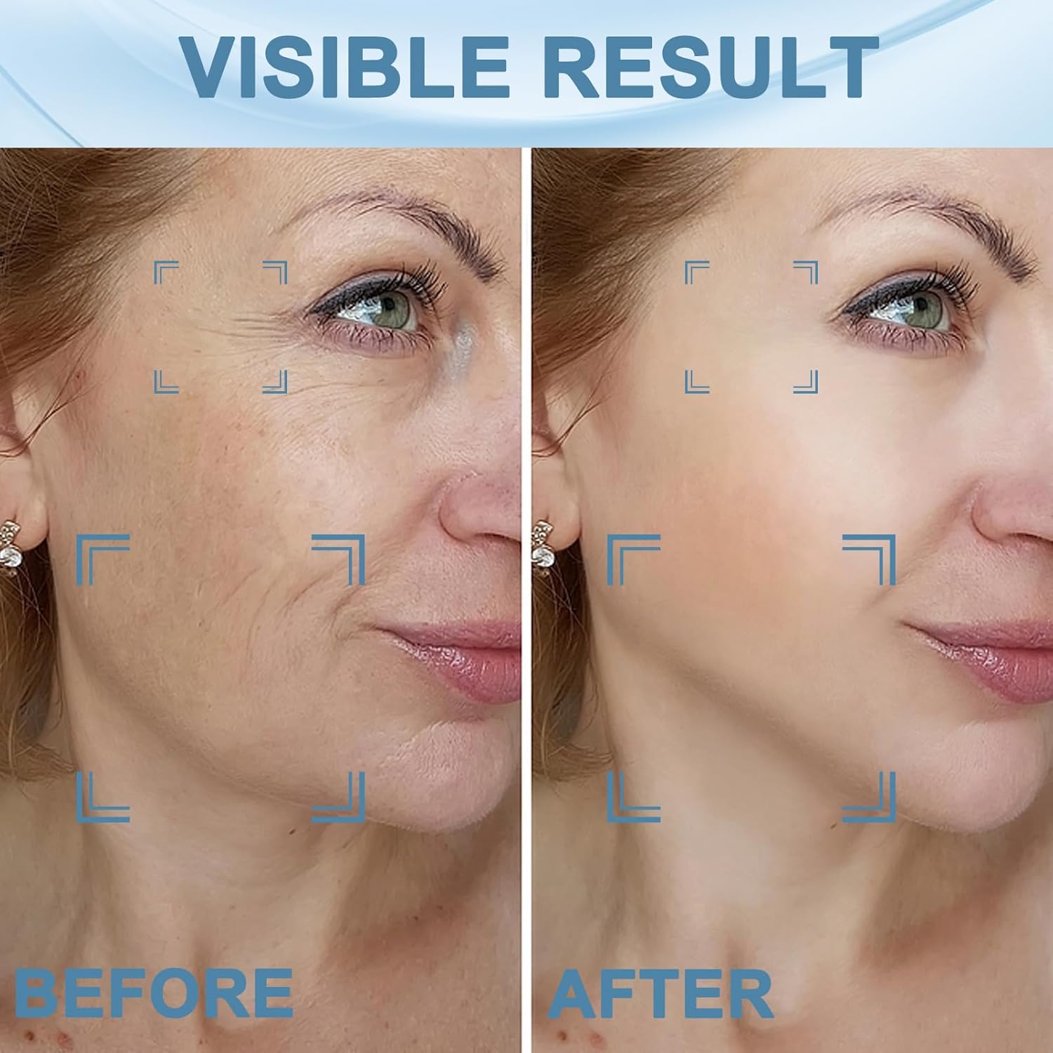 دستگاه ماساژور صورت و گردن